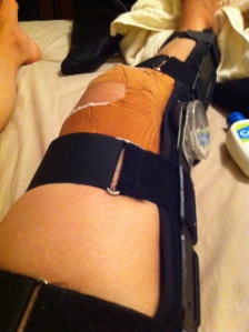 Broken Knee :(